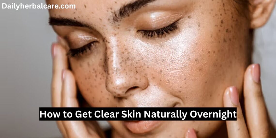 How to Get Clear Skin Naturally Overnight