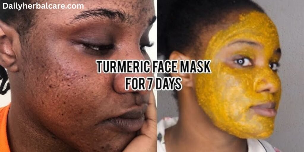 Turmeric and Honey Face Mask Benefits